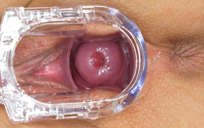 Women's vagina from the inside