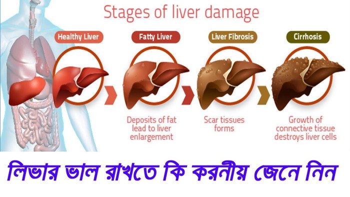 Stages of liver damage to alcohol