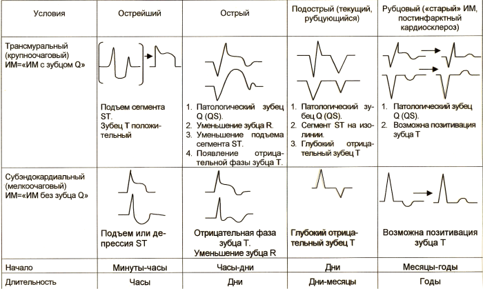 ECG at IBS: myocardial infarction, acute period