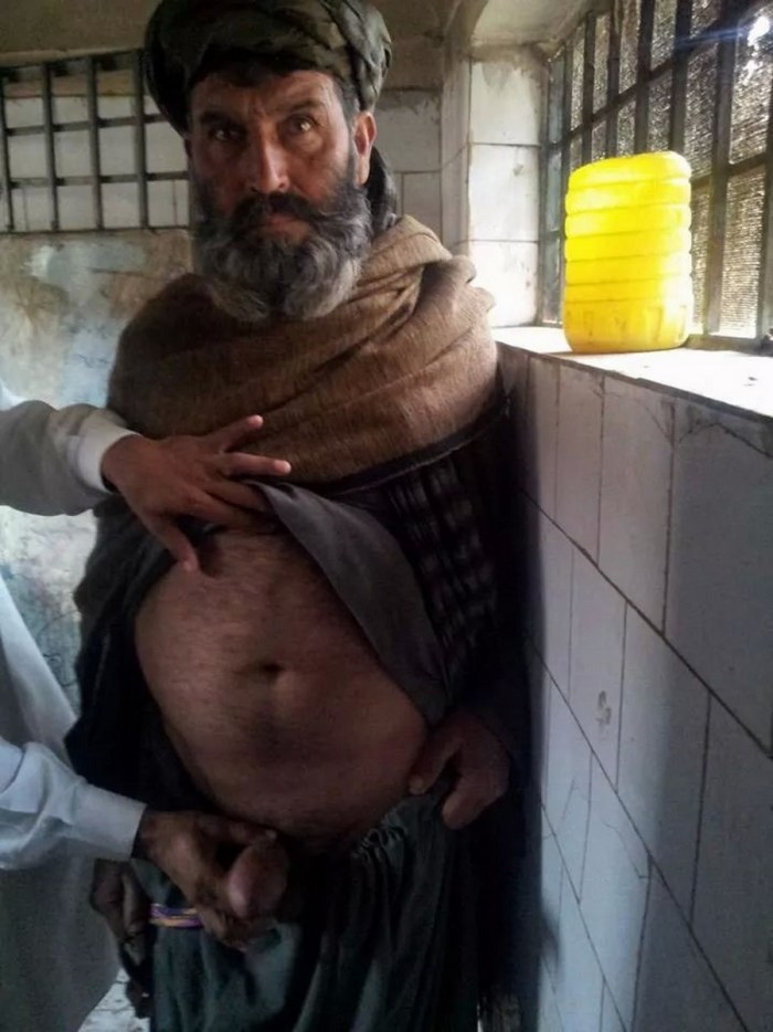 Naked old people Pakistanis