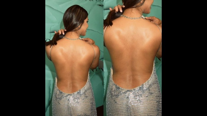 Beautiful wide hips with cellulite