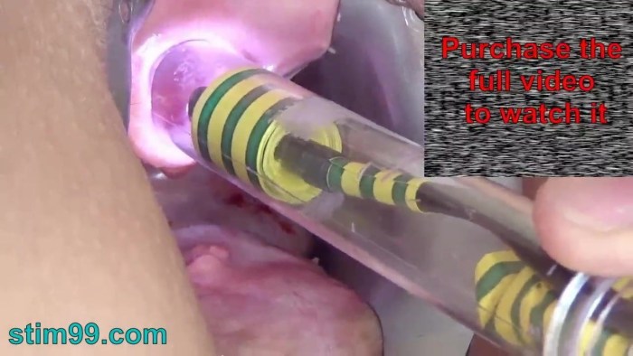 Masturbation of female urethra