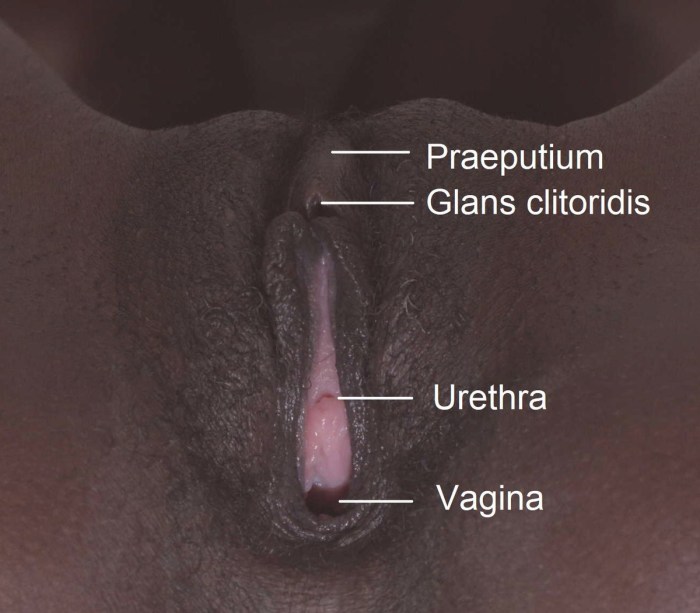 The woman was cut off the clitoris