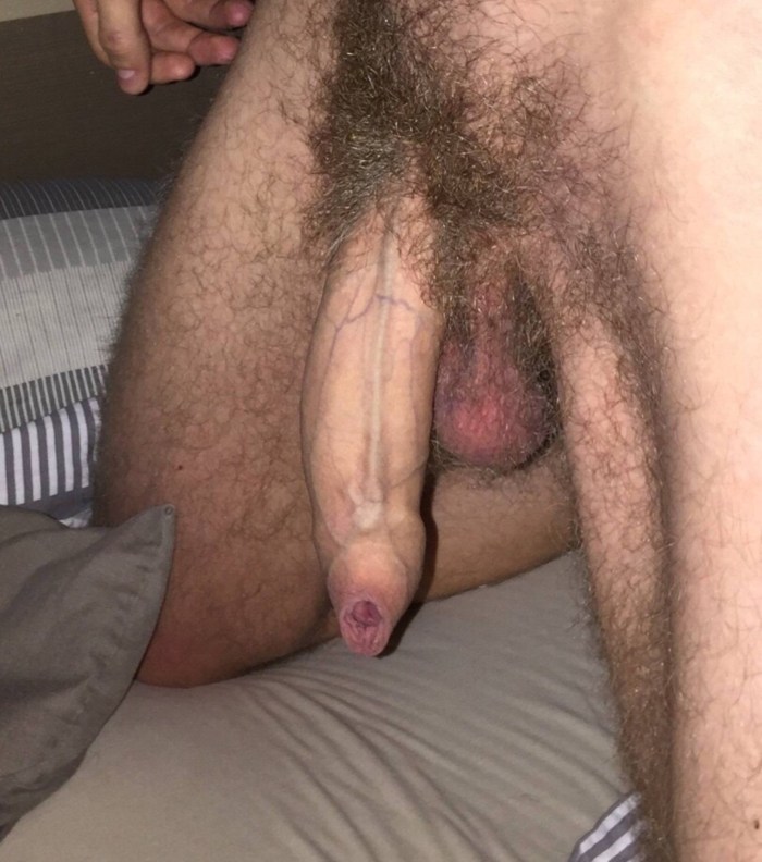 Giant hairy members