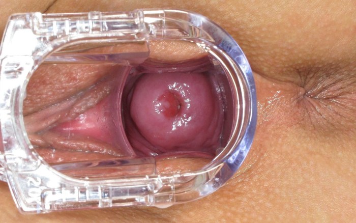Speculum girl