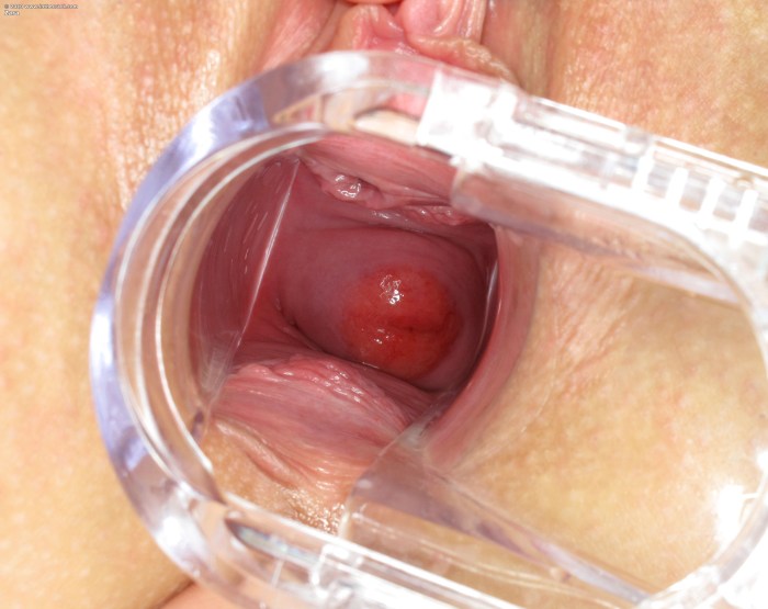 The camera inside the vagina