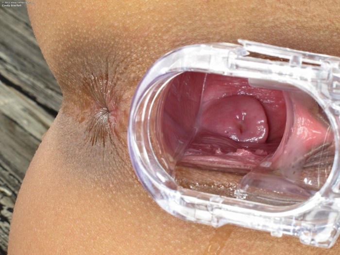 Inside the vagina is large