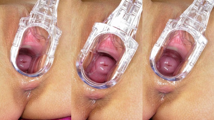 Camera in vagina girls