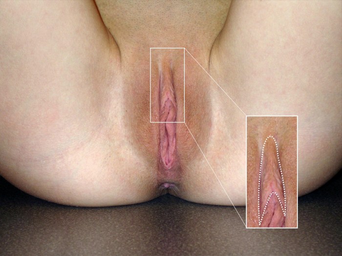 My pussy is cut