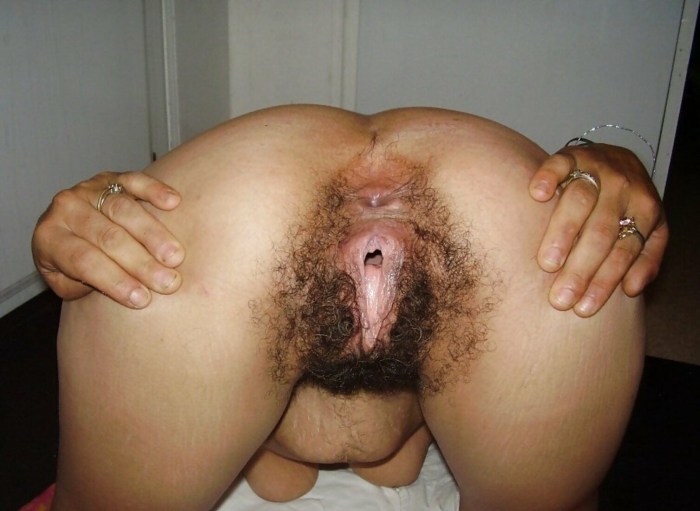 Hairy woman's ass