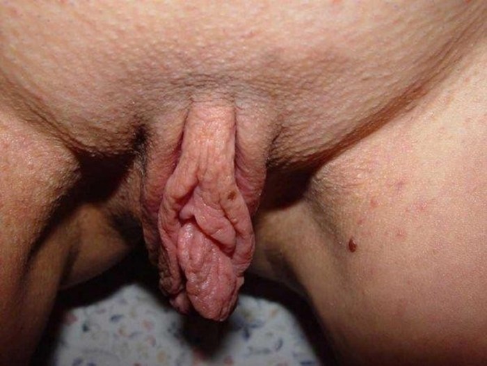A huge clitoris is large