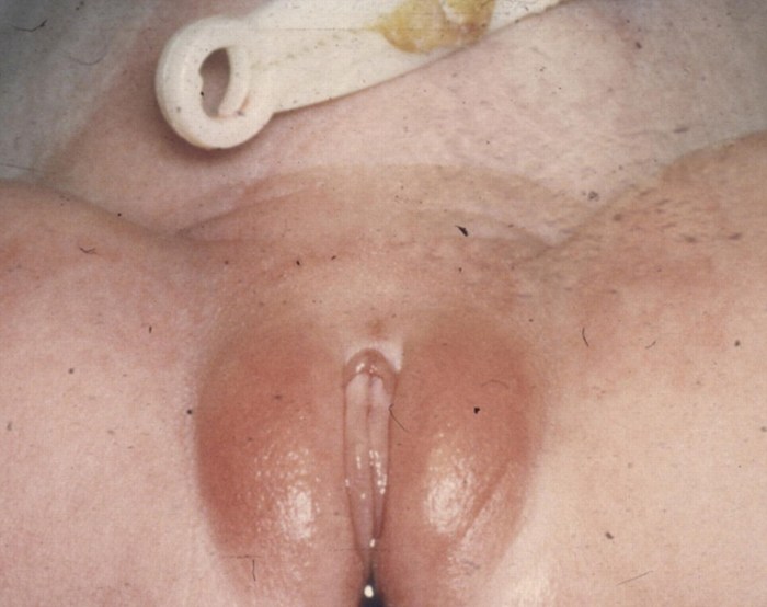 Girls with chubby labia