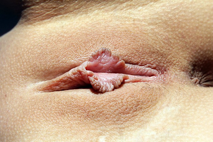 Vagina examination in a teenager