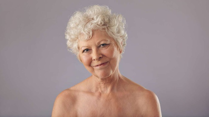 Burned elderly women