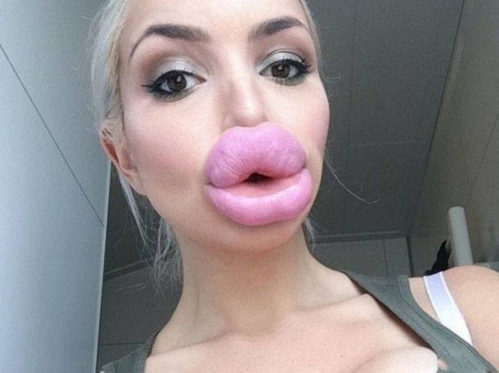Silicone lips
