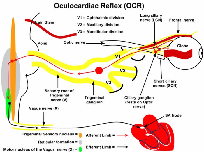 Oculocardiac Reflex