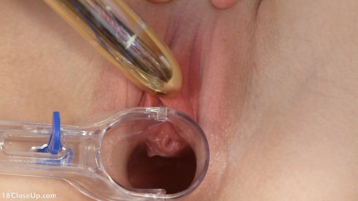 Speculum with a dirty conversation