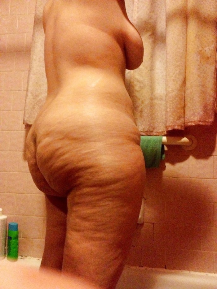 Naked cellulite hairy