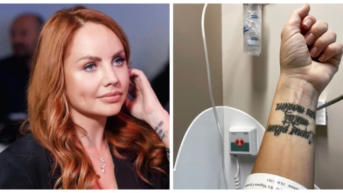 The condition of the singer Maxim