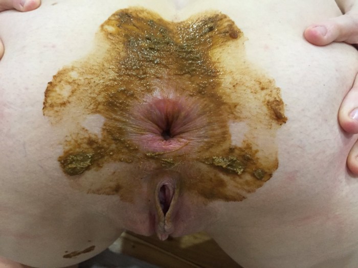 Hairy anus in panties