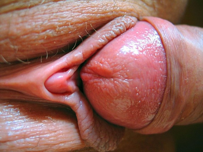 Executed clitoris