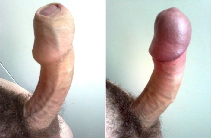 Huge cock close -up