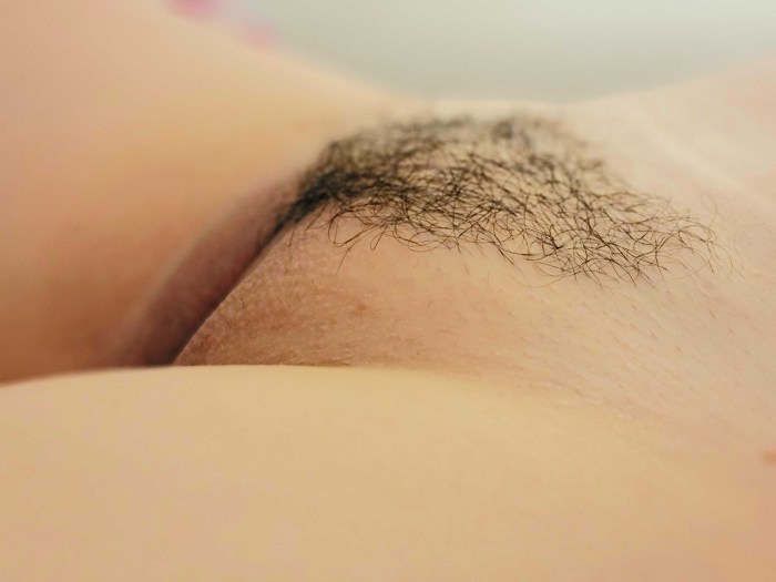 Bright hair on the pubis