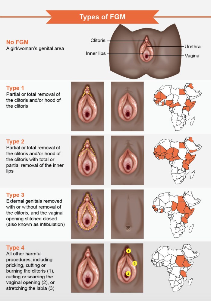 Very fat black vagina