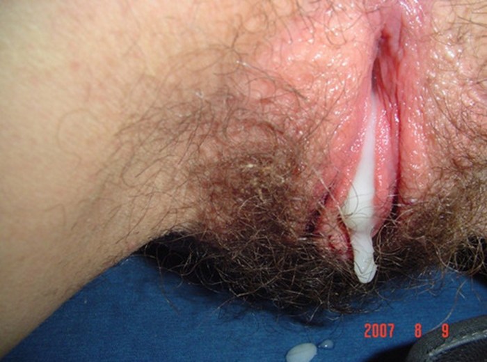 Vagina Completes Close -up