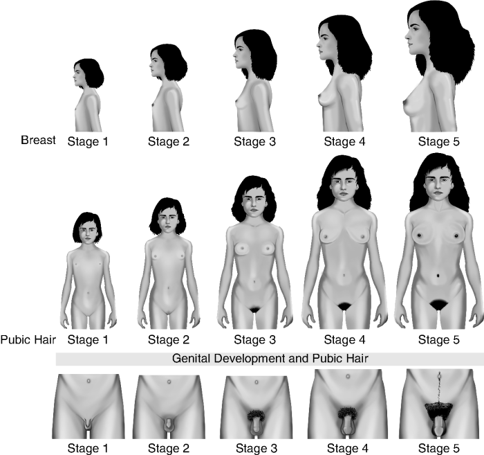 Girl's breasts puberty