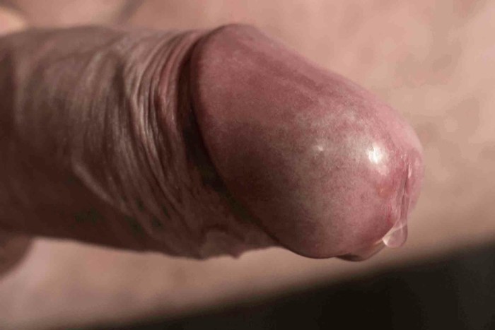 Close -up