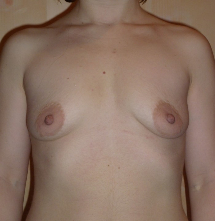 Young little boobs