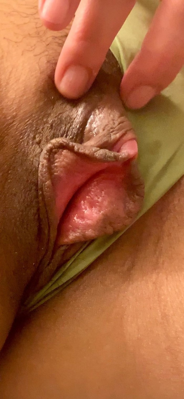 Naked women with a large clitoris