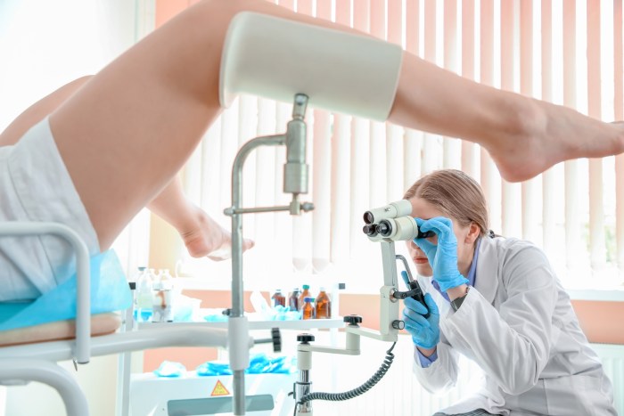 Gynecologist Kolposcopy