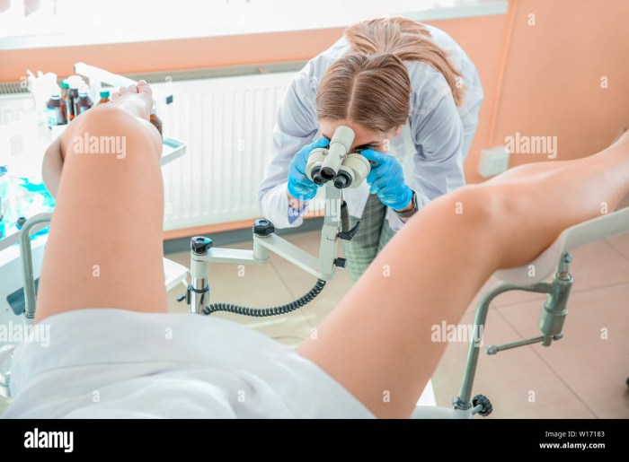 Woman gynecologist in gloves