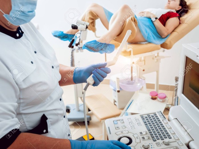 Gynecologist's ultrasound