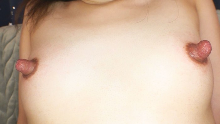 Sensitive Nipples