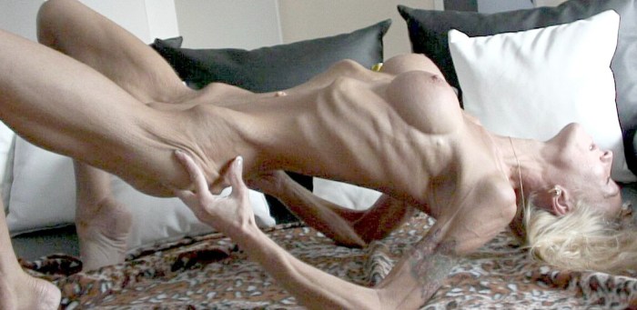 Anorexics with huge tits