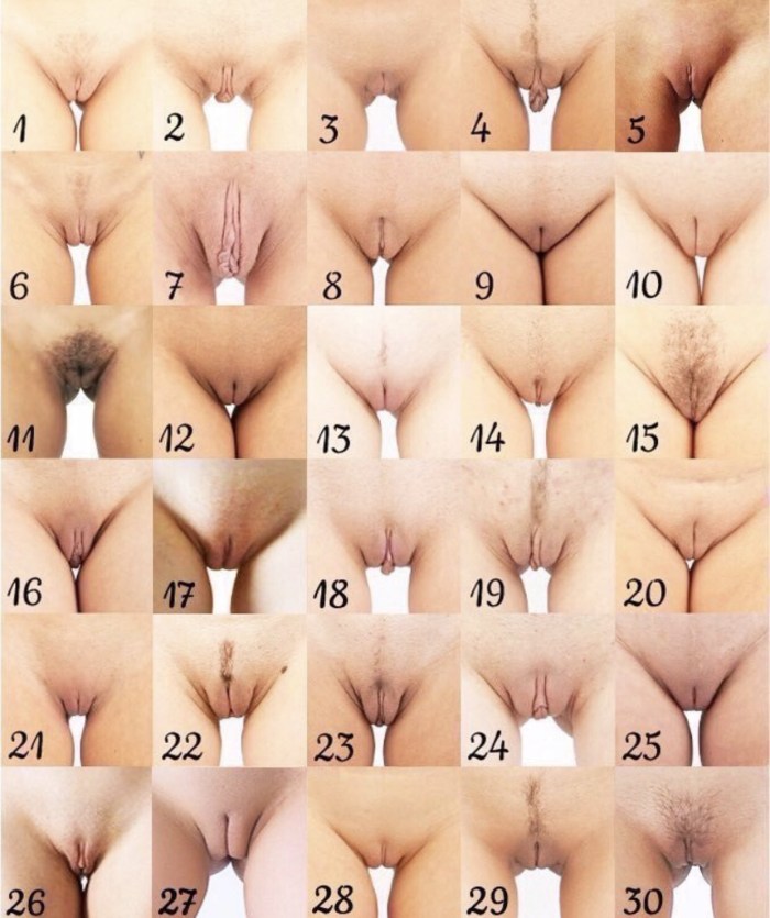 Classification of female vagina