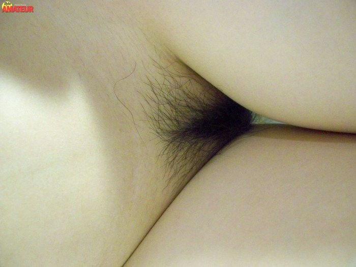 Bright hair on the pubis