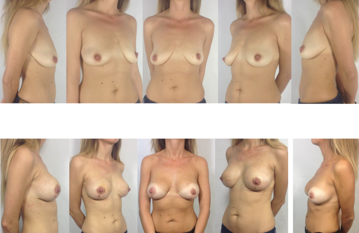 Naked chest of different shapes