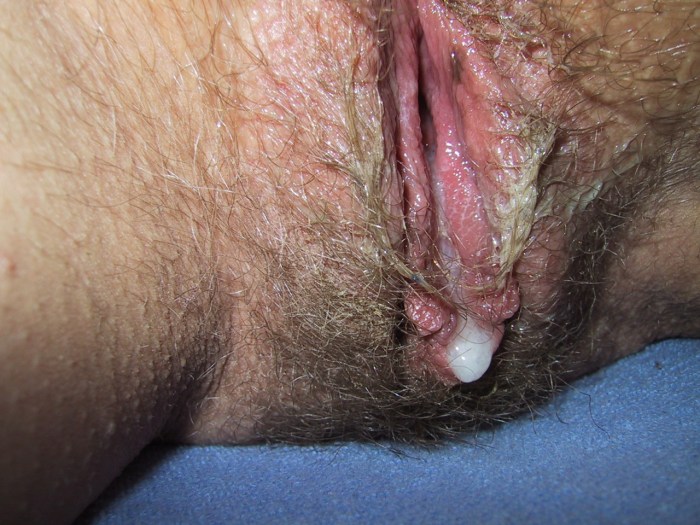 Hairy vagin in smegma