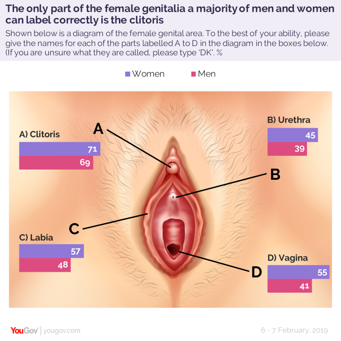 Vagina after the operation to change the floor