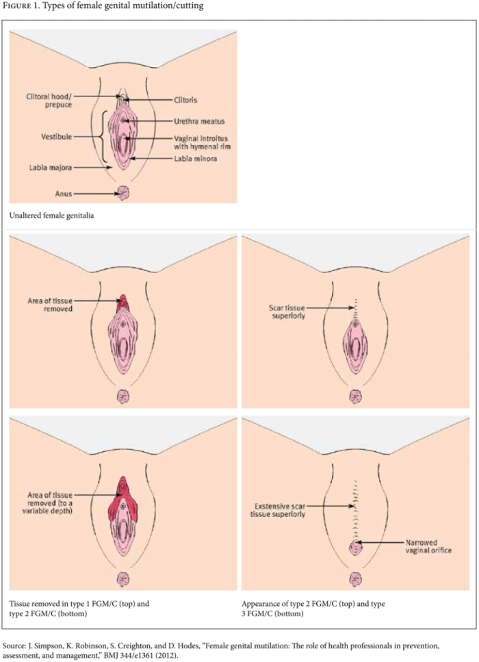 Classification of female vagina
