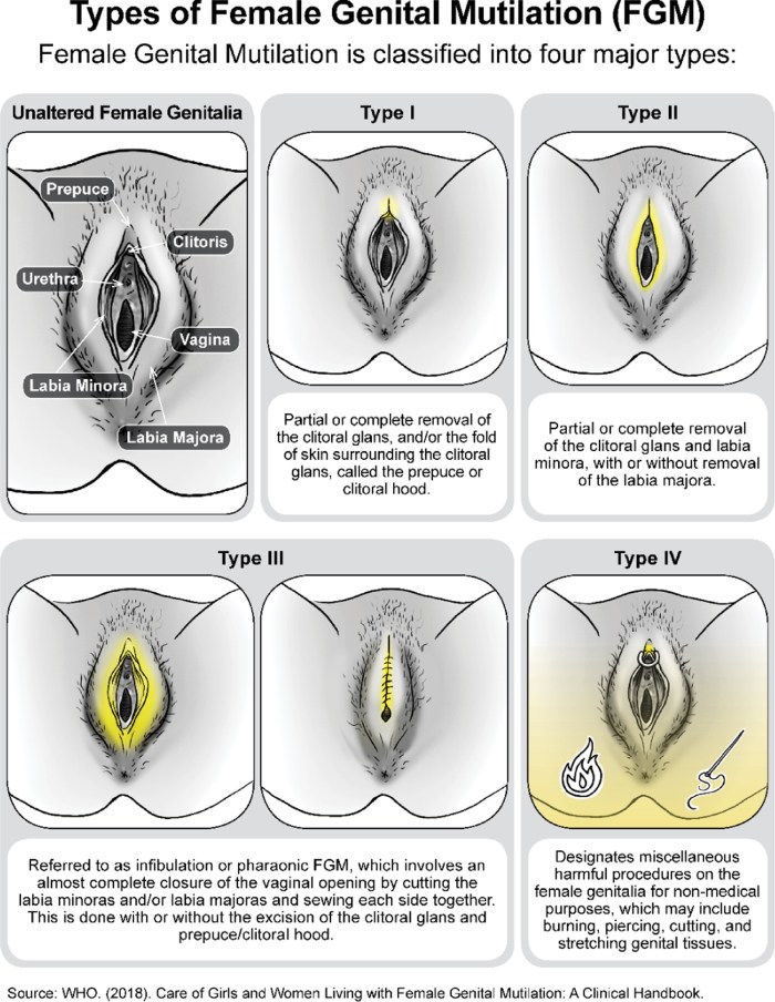 Shaved male genitals before and after