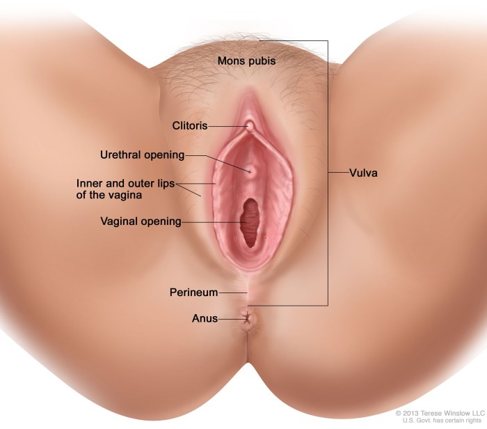 Vulva after female circumcision