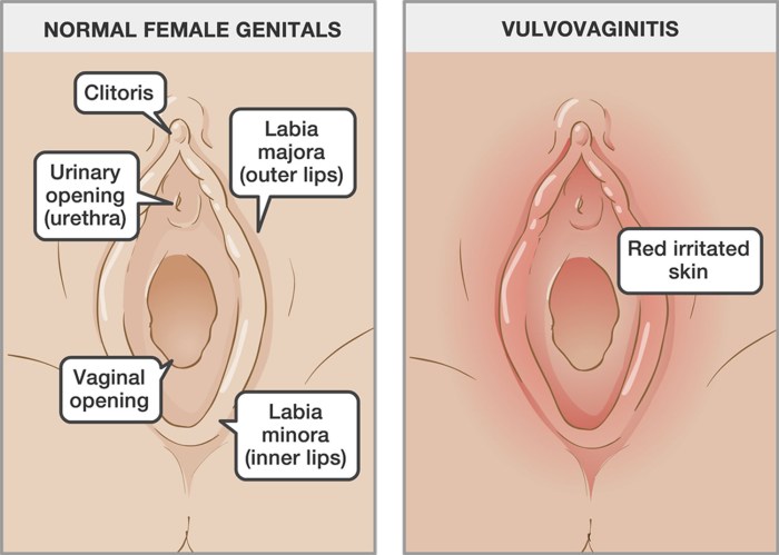 Different forms of female pussies