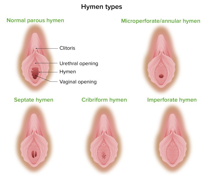 Forms vaginal