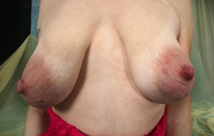 Naked women with different forms of breasts