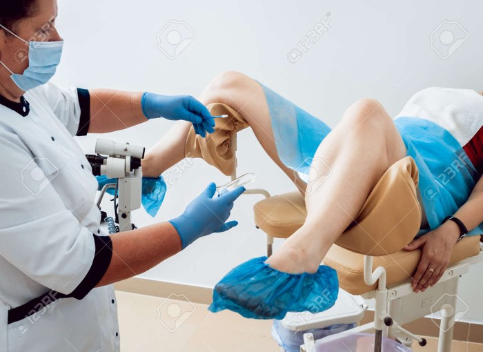 Examination of a gynecologist in 14